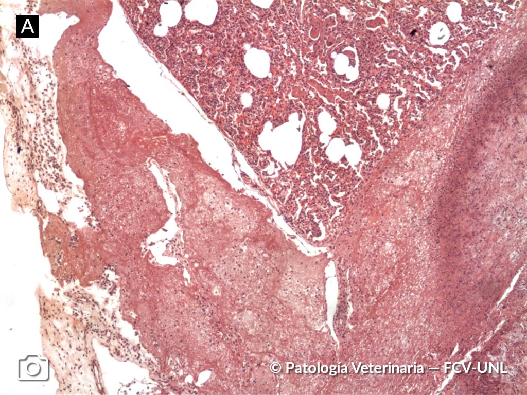 histología de fibrina